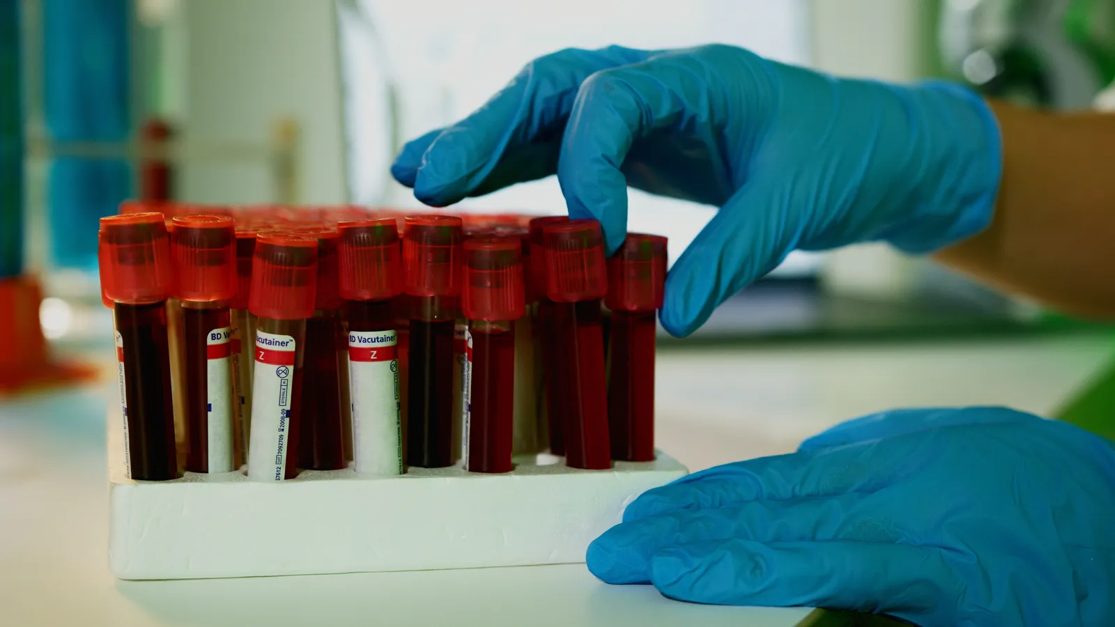 Blue-gloved hands lifting a blood collection tube from a rack of filled, red-capped sample tubes on a laboratory bench.